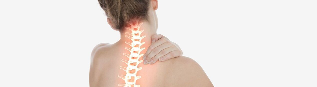 Osteohondroza vratne hrbtenice pri ženskah
